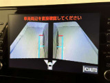 サイドモニターがあれば、見えにくい側方下部も確認可能できます。