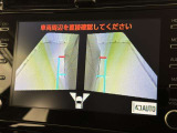 サイドモニターがあれば、見えにくい側方下部も確認可能できます。