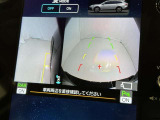 サイドモニターがあれば、見えにくい側方下部も確認可能できます。