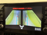 サイドモニターがあれば、見えにくい側方下部も確認可能できます。