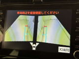 サイドモニターがあれば、見えにくい側方下部も確認可能できます。