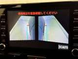 サイドモニターがあれば、見えにくい側方下部も確認可能できます。
