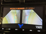 サイドモニターがあれば、見えにくい側方下部も確認可能できます。