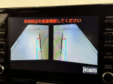 サイドモニターがあれば、見えにくい側方下部も確認可能できます。