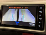 サイドモニターがあれば、見えにくい側方下部も確認可能できます。