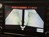 サイドモニターがあれば、見えにくい側方下部も確認可能できます。