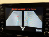 サイドモニターがあれば、見えにくい側方下部も確認可能できます。