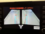 サイドモニターがあれば、見えにくい側方下部も確認可能できます。
