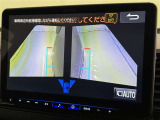 サイドモニターがあれば、見えにくい側方下部も確認可能できます。